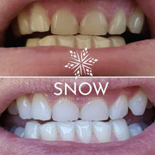 Load image into Gallery viewer, Floyd Mayweather's Snow Teeth Whitening™ At-Home System [All-in-One Kit]
