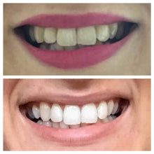 Load image into Gallery viewer, Snow® Teeth Whitening At-Home System [All-in-One Kit] - $99
